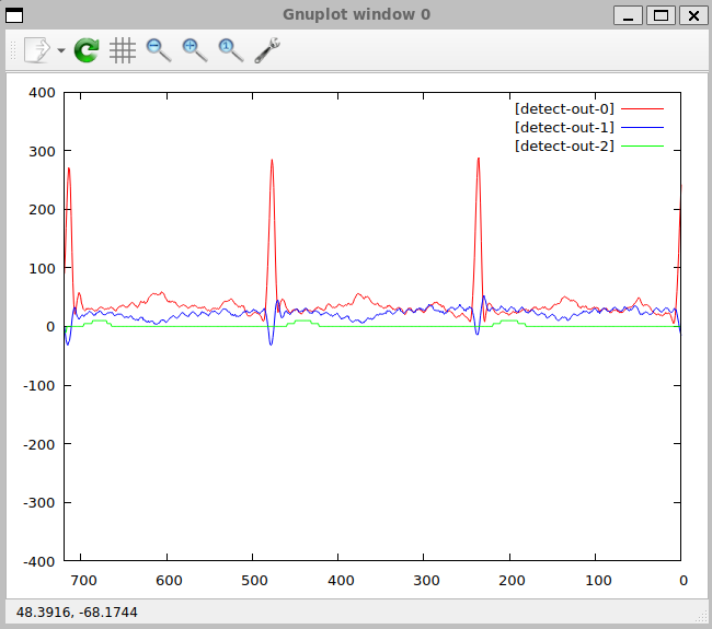 gnuplot QRS-detection window: MLII, V1, and the detection signal on record 205